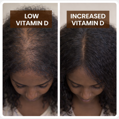 Serenro Health™ Vitamin D3 & K2 Supplement